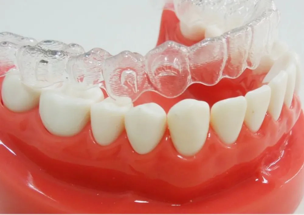 歯列矯正を併用するケース