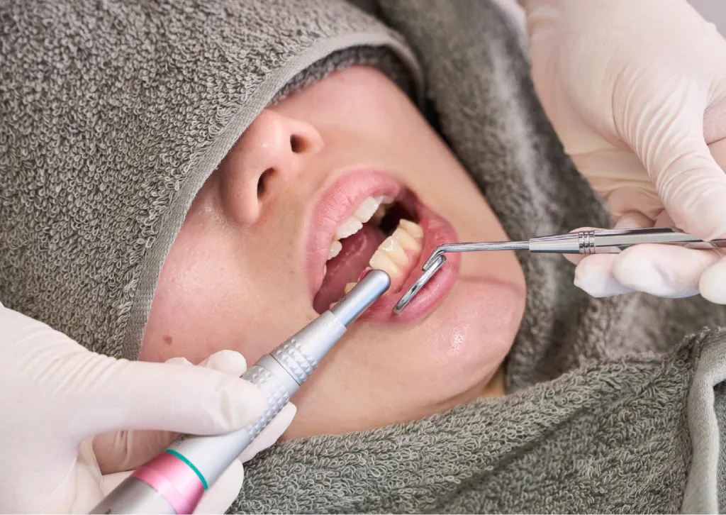歯周基本治療の徹底