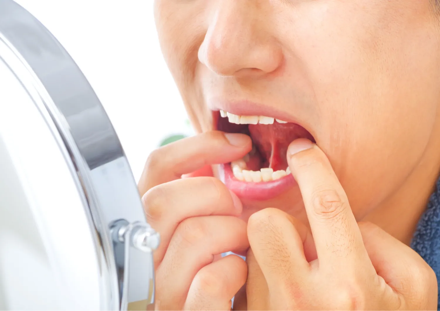 歯周病症状のセルフチェック